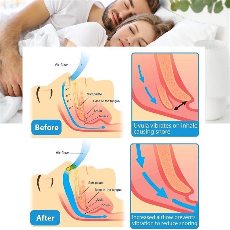 Anti-Snoring Corrector Snore Prevention Gadget Anti-Snore Device Snore Elimination Nose Clip Sleep Night
