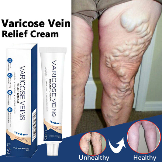 |200007763:201441035;14:200006156#20Pcs Varicose Cream