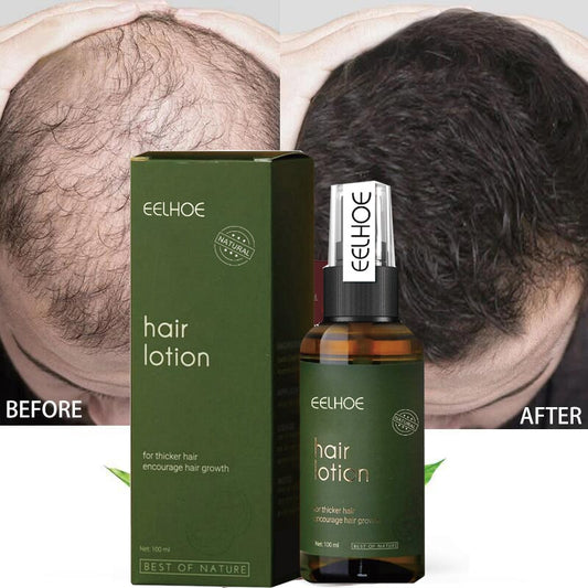 Anti Hair Loss Hair Growth Spray Essence Scalp Treatment Prevent Hair Thinning Dry Frizzy Repair Damaged Natural Care Products