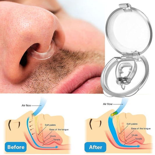 Anti-Snoring Corrector Snore Prevention Gadget  Anti-Snore Device Snore Elimination Nose Clip  Sleep Night